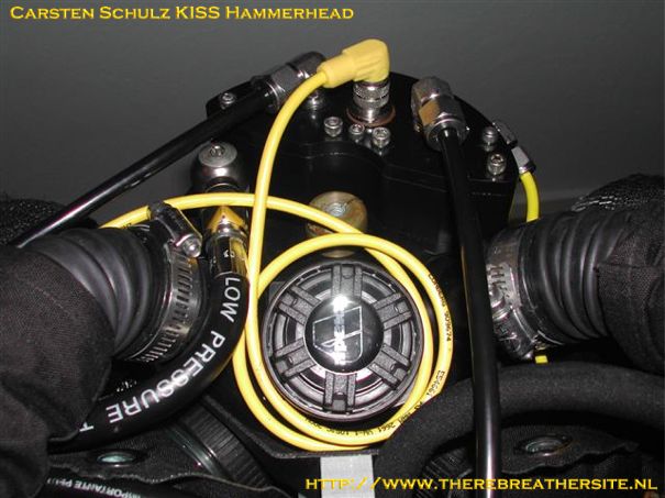 KISS with HH kidney